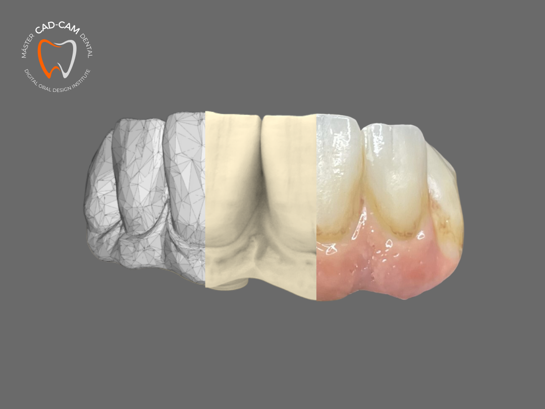 MASTER CAD CAM DENTAL EN MADRID