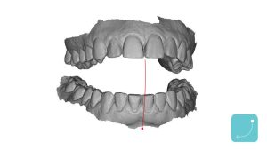 OXO jaw01 1