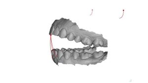 OXO jaw02 1