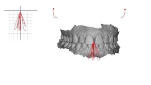 OXO jaw03