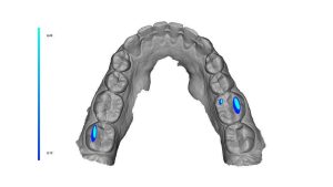 OXO jaw06