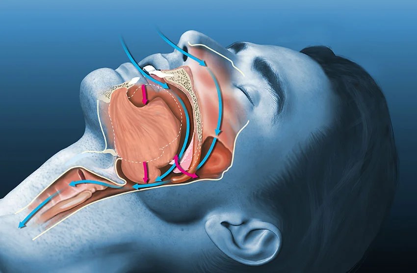 ODONTOLOGÍA DEL SUEÑO